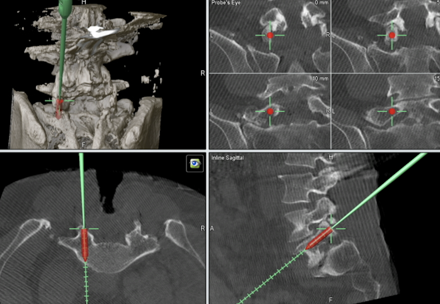 脊椎・脊髄センター - 大阪けいさつ病院｜大阪国際メディカル