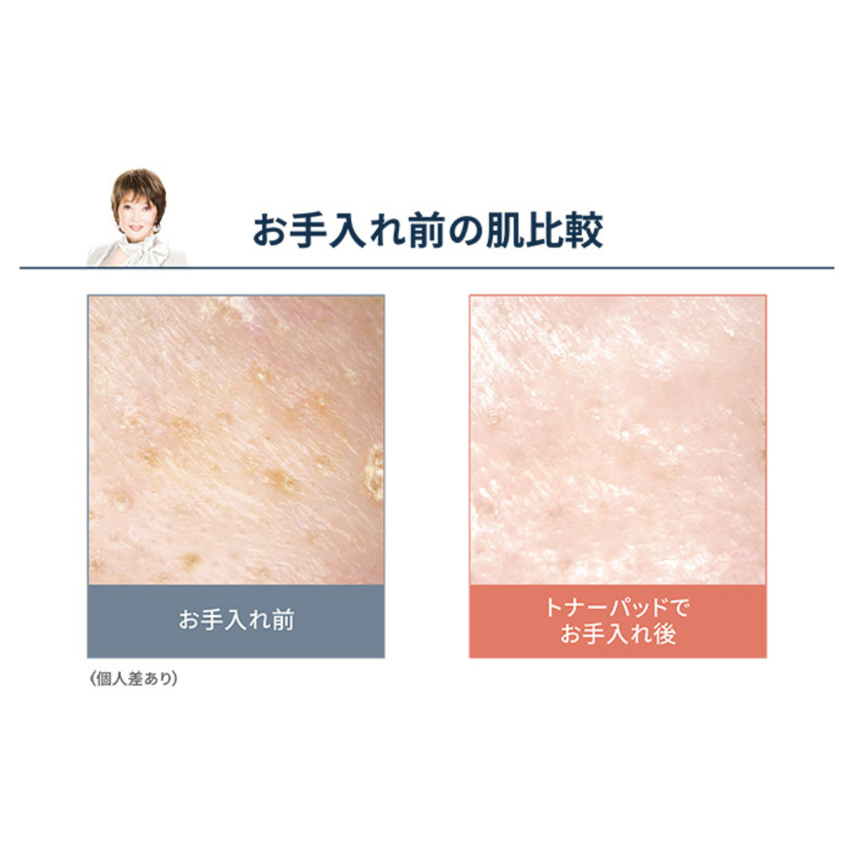 たかの友梨エステファクト トナーパッド2個セット たかの友梨エステ