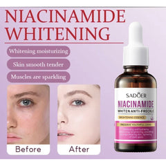 Sadoer Niacinamide Whiten Anti-Freckle Brightening Essence – 30ml