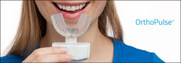 加速装置（スピード矯正）とは？インビザライン矯正を検討中の方へ