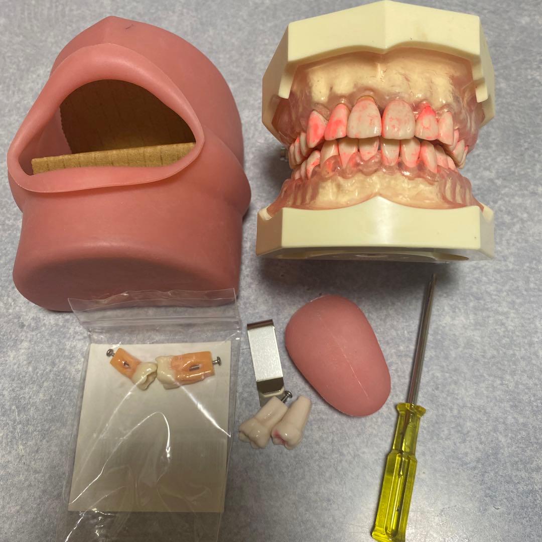 NISSIN DENTAL MODEL 顎模型 頬粘膜 舌付 - メルカリ