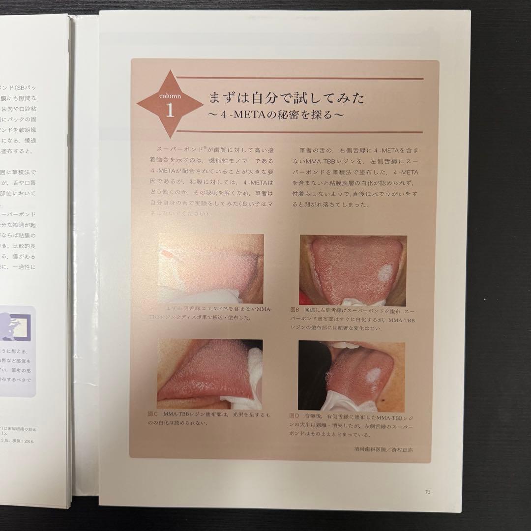 完全攻略 スーパーボンド® 接着の悩み即解決