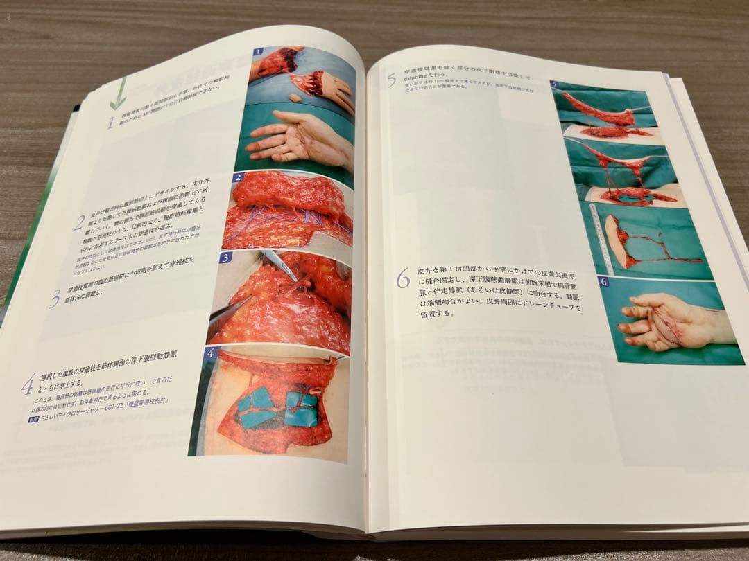 やさしい皮弁 - 平瀬健一