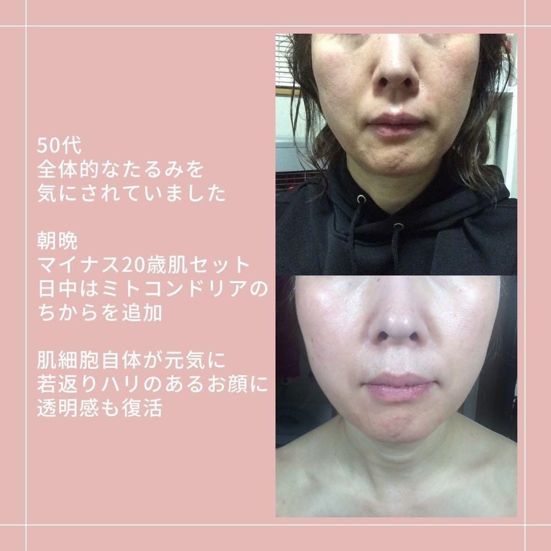 アキノリオ New輝魔女セット