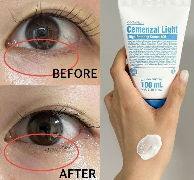 最新正規品]セメンザルライトクリーム＆ ビバンクエントマンカ