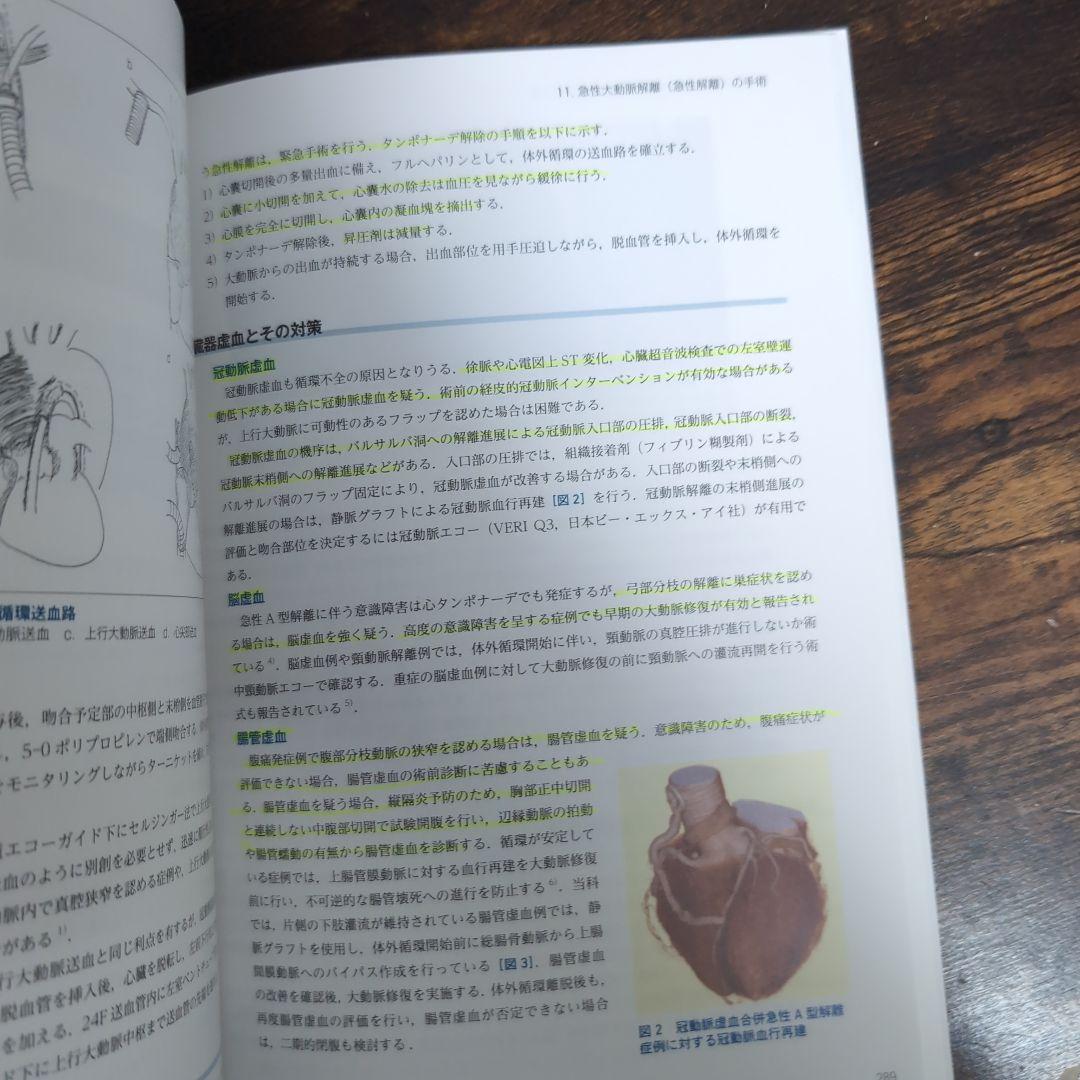 心臓血管外科手術虎の巻 - メルカリ